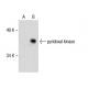 pyridoxal kinase Antibody (F-12) - Western Blotting - Image 286017