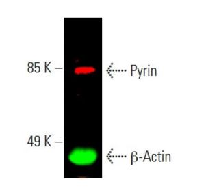 Pyrin Antibody (C-11) - Western Blotting - Image 388232The Double Nickase Plasmid features a U6 promoter for sgRNA expression, a 20 nt targeting sequence, and a gRNA scaffold to guide Cas9n. It includes a CBh promoter for Cas9n (D10A) and puromycin resistance, GFP for transfection verification, and nuclear localization signals (NLS). The 2A peptide allows co-expression of Cas9n and Puro from a single promoter, enabling precise genome editing with reduced off-target effects.