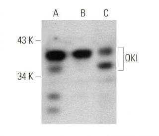 QKI Antibody (N147/6) - Western Blotting - Image 368573