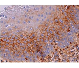 immunohistochemistry image from recommended R-cadherin (D-9) monoclonal antibody replacement. Image 368919