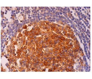 immunohistochemistry image from recommended R1 (A-10) monoclonal antibody replacement. Image 293700