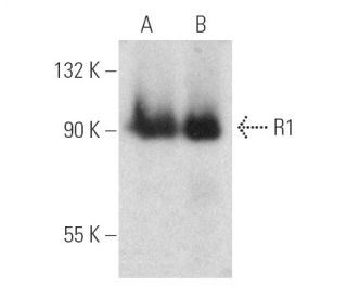 R1 Antibody (E-7) - Western Blotting - Image 389384The Double Nickase Plasmid features a U6 promoter for sgRNA expression, a 20 nt targeting sequence, and a gRNA scaffold to guide Cas9n. It includes a CBh promoter for Cas9n (D10A) and puromycin resistance, GFP for transfection verification, and nuclear localization signals (NLS). The 2A peptide allows co-expression of Cas9n and Puro from a single promoter, enabling precise genome editing with reduced off-target effects.