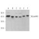 western blotting image from recommended R2/p53R2 (F-9) monoclonal antibody replacement. Image 354429