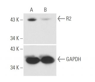 R2 siRNA (h): sc-36338. Western blot analysis of R2 expression in non-transfected control (A) and R2 siRNA transfected (B) 