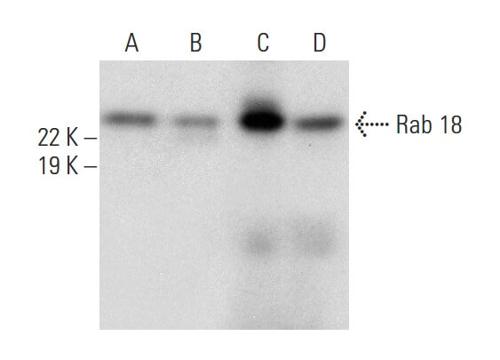 Anti-Rab 18 Antibody (D-5) | SCBT - Santa Cruz Biotechnology