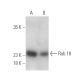 Rab 18 Antibody (D-5) - Western Blotting - Image 394983 