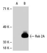 Anti Rab 2 Rab 2 Antibody (F-8) | SCBT - Santa Cruz Biotechnology