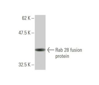 Rab 28 Antibody (2C6) - Western Blotting - Image 348999