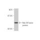 Rab 28 Antibody (2C6) - Western Blotting - Image 348999
