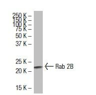 Anti Rab 2 Rab 2B Antibody (139.1) | SCBT - Santa Cruz Biotechnology