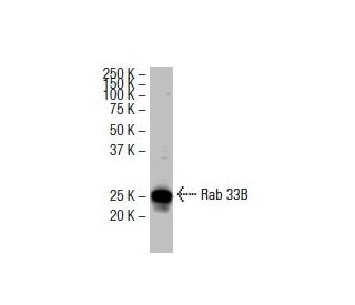 Rab 33B Antibody (RR-3) - Western Blotting - Image 33571Each CRISPR/Cas9 Knockout (KO) Plasmid product consists of a pool of 3 plasmids designed to ensure identification and cleavage of a specific gene for maximum knockout efficiency. Each plasmid encodes a unique 20 nt sequence derived from the GeCKO (v2) library. 