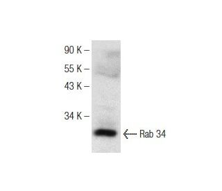 Rab 34 Antibody (E-10) - Western Blotting - Image 147343 