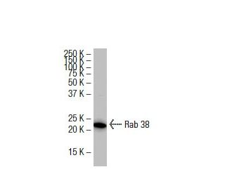 Rab 38 Antibody (11B-7) - Western Blotting - Image 33569 