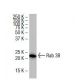 Rab 38 Antibody (11B-7) - Western Blotting - Image 33569 