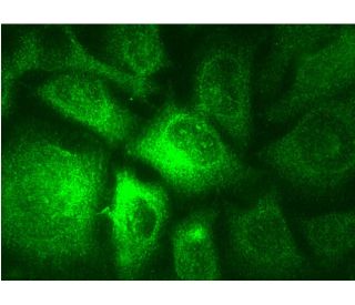 immunofluorescence image from recommended Rab 3A (C-7) monoclonal antibody replacement. Image 145179