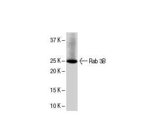 Rab 3B Antibody (48-K2) - Western Blotting - Image 33561 