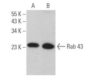 Rab 43 Antibody (D-12) - Western Blotting - Image 371086Each CRISPR/Cas9 Knockout (KO) Plasmid product consists of a pool of 3 plasmids designed to ensure identification and cleavage of a specific gene for maximum knockout efficiency. Each plasmid encodes a unique 20 nt sequence derived from the GeCKO (v2) library.