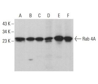 western blotting image from recommended Rab 4A (4E11) monoclonal antibody replacement. Image 376416