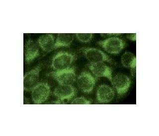 Rab 5 Antibody (D-11) | SCBT - Santa Cruz Biotechnology