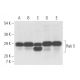 western blotting image from recommended Rab 5 (D-11) monoclonal antibody replacement. Image 11530