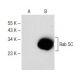 Rab 5C Antibody (D-6) - Western Blotting - Image 147854