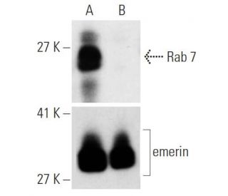 Rab 7 siRNA (h): sc-29460. Western blot analysis of Rab 7 expression in non-transfected control (A) and Rab 7 siRNA transf 