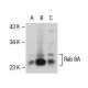western blotting image from recommended Rab 8A (63-BJ) monoclonal antibody replacement. Image 49420