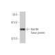Rab 8B Antibody (1E4) - Western Blotting - Image 349585 