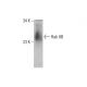 Rab 8B Antibody (1E4) - Western Blotting - Image 384535 