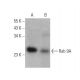 western blotting image from recommended Rab 9A (Mab9) monoclonal antibody replacement. Image 358612
