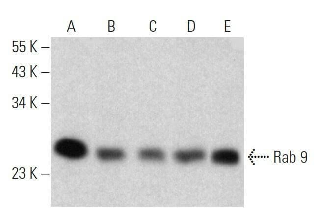 Asi Rashed Rab 9 Rab 9 항체 (G-5) | SCBT - Santa Cruz Biotechnology