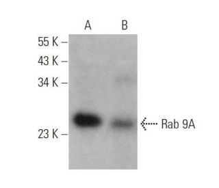 western blotting image from recommended Rab 9A (Mab9) monoclonal antibody replacement. Image 358612