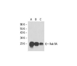 Rab 9A Antibody (6D717) - Western Blotting - Image 51151