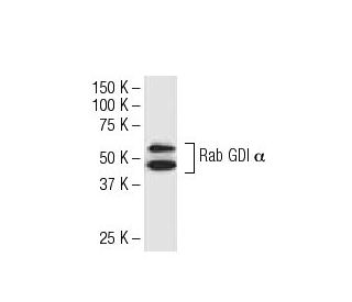 Rab GDI &alpha; Antibody (47-E) - Western Blotting - Image 33557