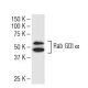 Rab GDI α Antibody (47-E) - Western Blotting - Image 33557