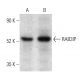 RAB3IP Antibody (B-1) - Western Blotting - Image 403564 