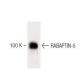 RABAPTIN-5 Antibody (20) - Western Blotting - Image 60426 