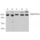 Este anticuerpo policlonal ha dejado de fabricarse. Consulta nuestro anticuerpo monoclonal recomendado <a href="rabaptin-5-antibody-b-8">RABAPTIN-5 (B-8)</a> (se muestran datos de muestra). western blotting image from recommended RABAPTIN-5 (B-8) monoclonal antibody replacement. Image 373015