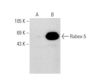 Rabex-5 Antibody (D-8) - Western Blotting - Image 64786 