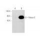 Rabex-5 Antibody (D-8) - Western Blotting - Image 64786 