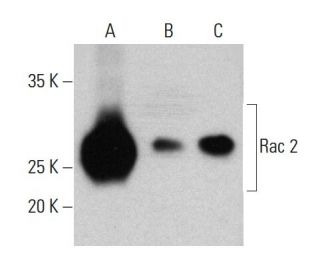 Rac 2 Antibody (3B8) - Western Blotting - Image 384283 