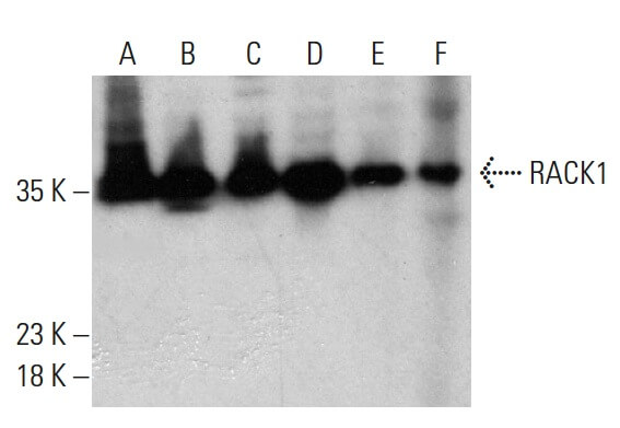 RACK1 Antibody (B-3) | SCBT - Santa Cruz Biotechnology