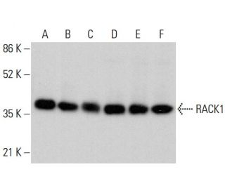 western blotting image from recommended RACK1 (B-3) monoclonal antibody replacement. Image 378757
