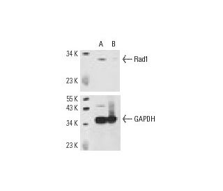 Rad1 siRNA (h): sc-36356. Western blot analysis of Rad1 expression in non-transfected control (A) and Rad1 siRNA transfect 