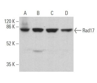 western blotting image from recommended Rad17 (H-3) monoclonal antibody replacement. Image 360304