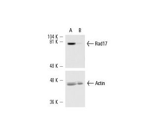 Rad17 siRNA (h): sc-36358. Western blot analysis of Rad17 expression in non-transfected control (A) and Rad17 siRNA transf 