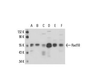 Rad18 Antibody (79B1048) - Western Blotting - Image 17440 