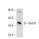 Rad18 Antibody (79B1048) - Western Blotting - Image 50710
