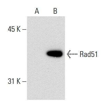 Rad51 Antibody 51RAD01 SCBT Santa Cruz Biotechnology