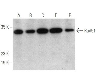western blotting image from recommended Rad51 (F-11) monoclonal antibody replacement. Image 360058